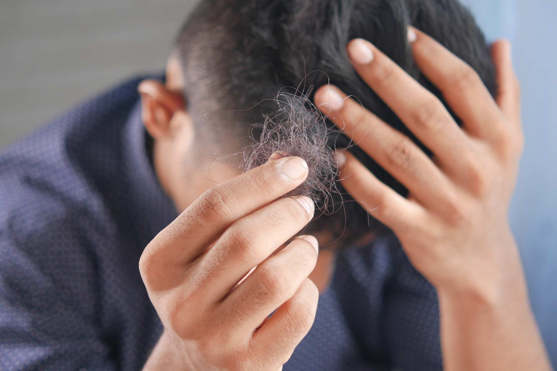 Is your diet causing your hair loss?
