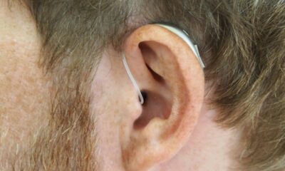 Understanding the Ear Diagram