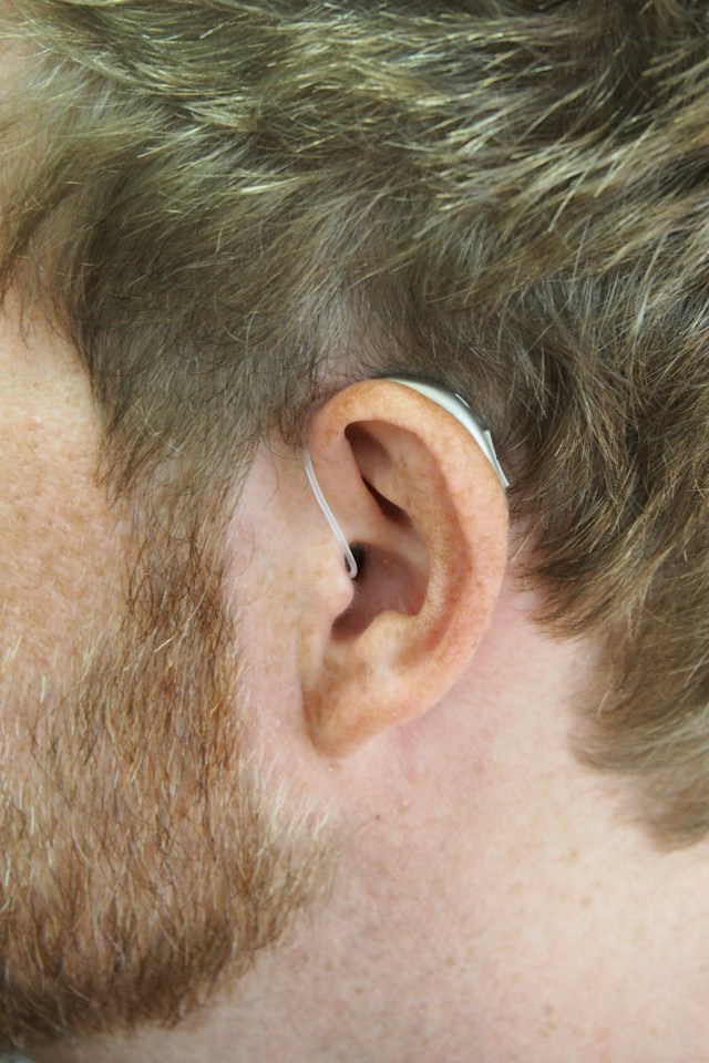 Understanding the Ear Diagram